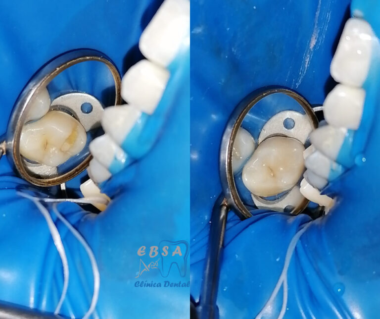 17389 ebsa dental oaxaca 768x644