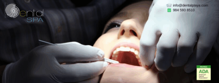 17489 dental spa playa del carmen 768x292