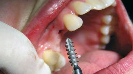 17523 clinica dental funnydent dentistas en matamoros