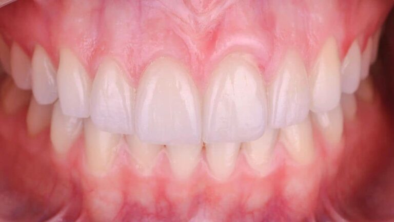 17561 dentista gustavo gaytan salim 768x432