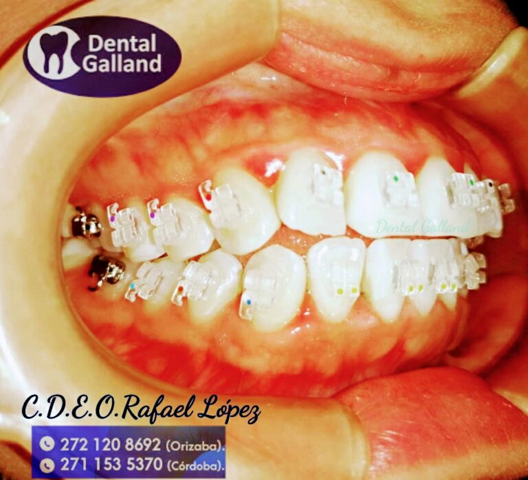 17567 dental galland orizaba 768x698