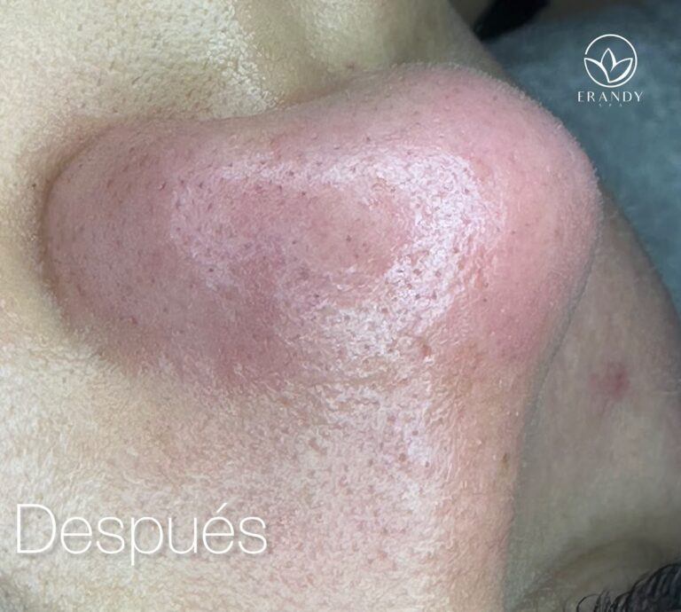 18826 erandy spa 768x690