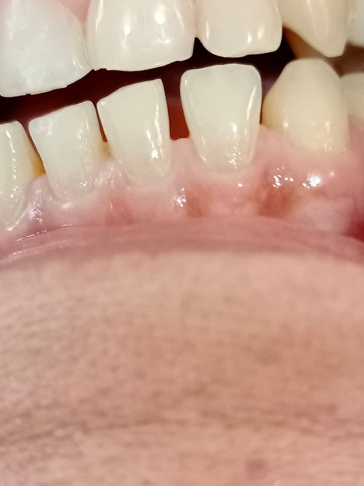 leetx-google-photo-47896-2 leetx-google-photo-47896-2