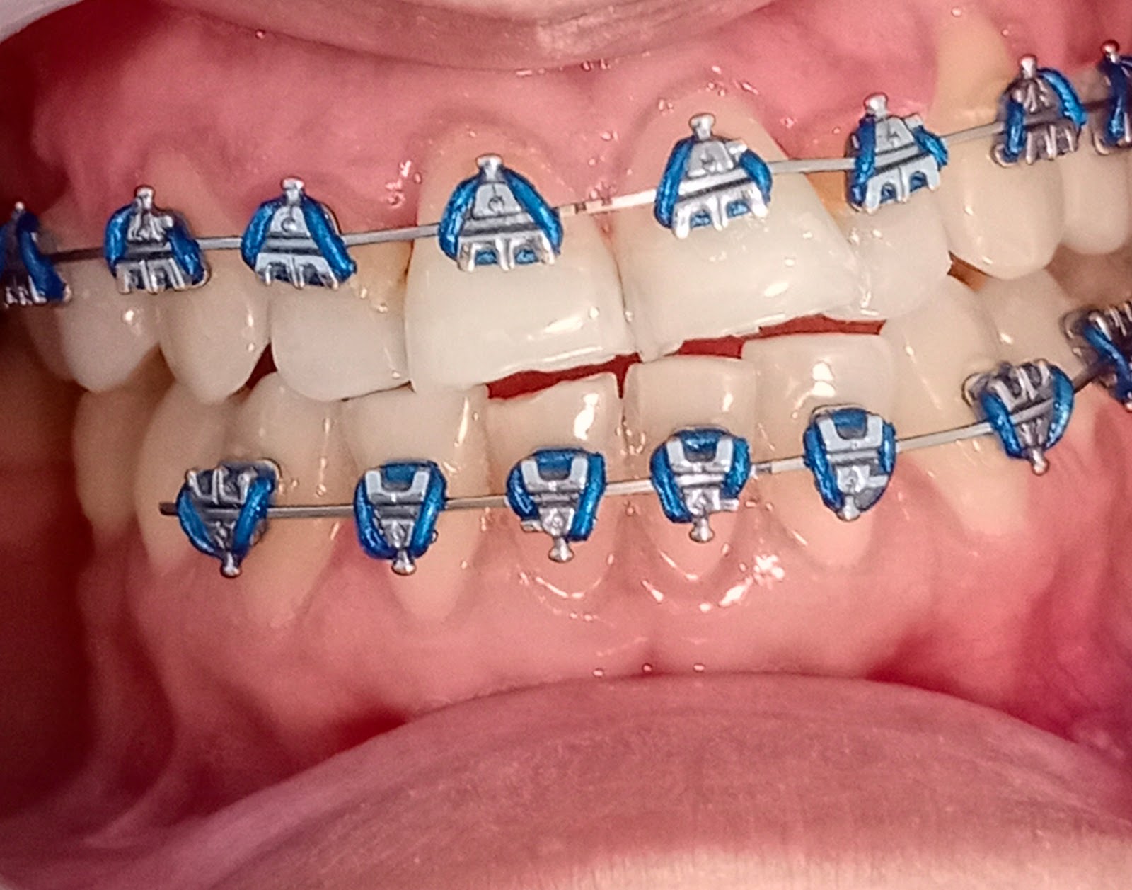 leetx-google-photo-47896-3 leetx-google-photo-47896-3