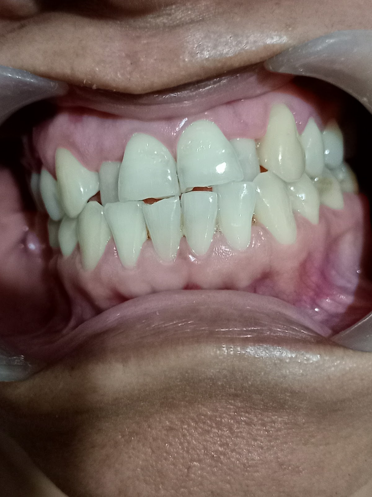 leetx-google-photo-47896-5 leetx-google-photo-47896-5