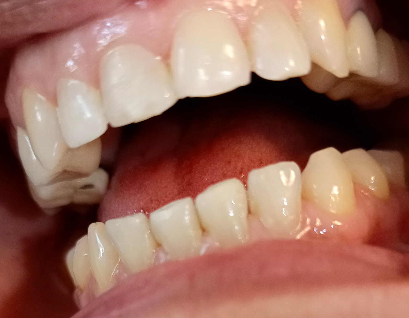 leetx-google-photo-47896-6 leetx-google-photo-47896-6