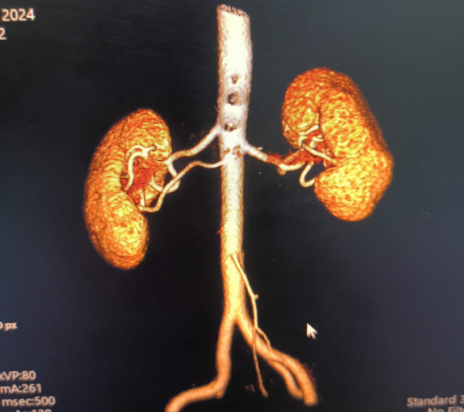 leetx-google-photo-49376-4 leetx-google-photo-49376-4