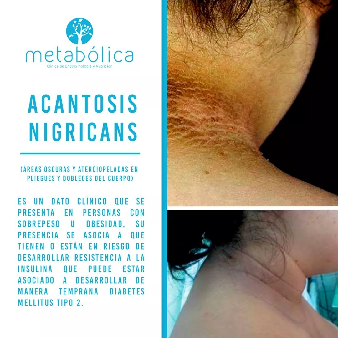 leetx-google-photo-49629-7 leetx-google-photo-49629-7